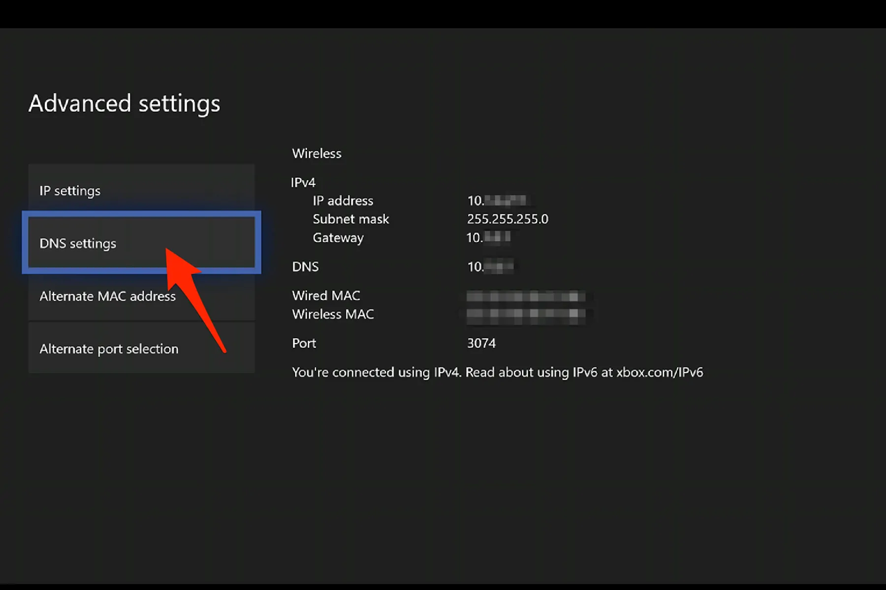 بهترین DNS ایکس باکس